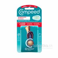 Compeed náplasť na pľuzgiere na chodidlách - športová 5ks